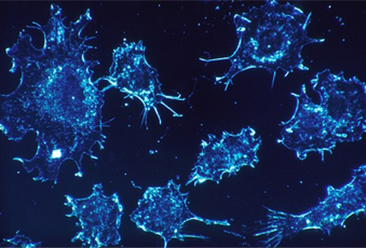癌癥患者福音！抗癌神藥明年有望來華 能治17種癌癥治愈率高達75%